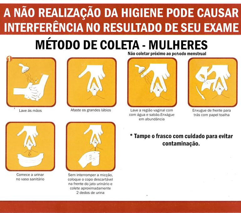 Sigla para exame de fezes